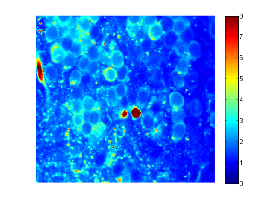 Estimate of numbers of photons per pixel; excerpt of the 512x512 image series used for generating the above plot. The bright (red) spots are blood vessels and not of interest.